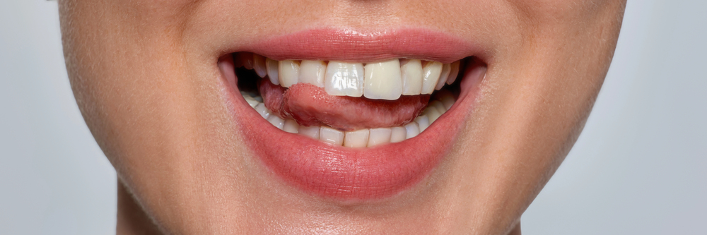 Close-up of a woman’s mouth with her tongue touching her teeth.